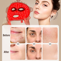 ULTREMA Red Light Therapy for Face, 7 Modes Led Face Mask Light Therapy with Remote, Portable Light Therapy Mask for Skin Care at Home, Travel (Beige) - Image 7